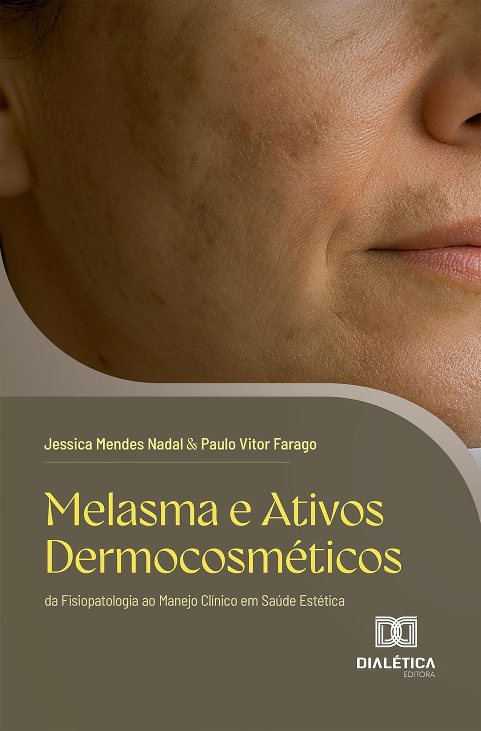 Melasma e Ativos Dermocosméticos: da Fisiopatologia ao Manejo Clínico em Saúde Estética (Portuguese Edition) (EPUB)