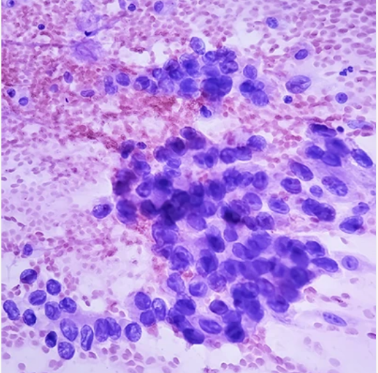 Cytopathology: Masters of Pathology Series 2026 (Videos + PDF)