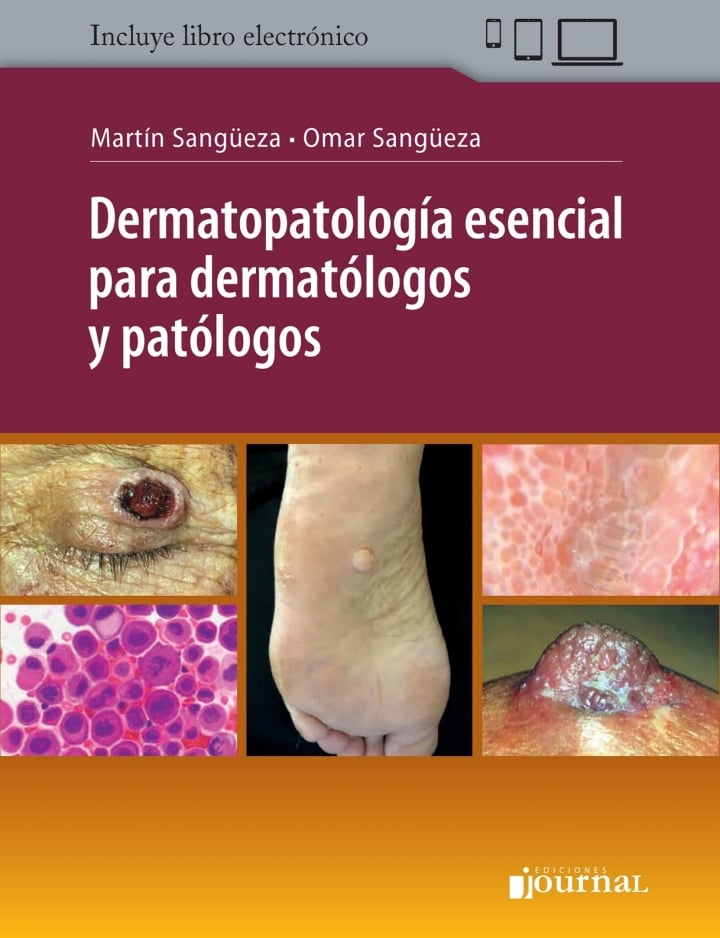 Dermatopatología esencial para dermatólogos y patólogos (Original PDF from Publisher)