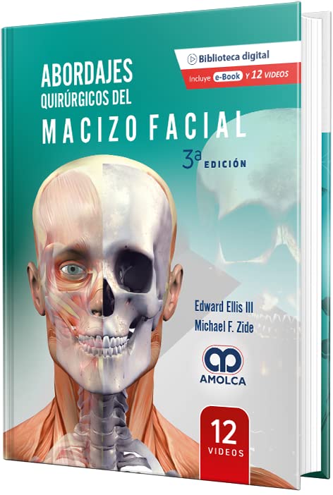 Abordajes Quirúrgicos del Macizo Facial, 3a edición (Scanned PDF)