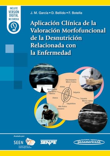 Aplicación Clínica de la Valoración Morfofuncional de la Desnutrición Relacionada con la Enfermedad (Original PDF from Publisher)