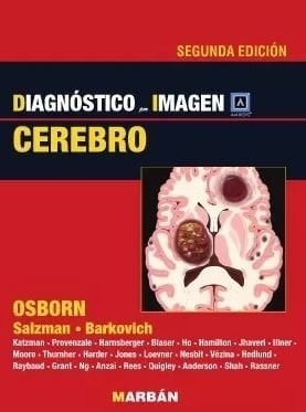 Diagnóstico por Imagen: Cerebro, 2a Edición (Scanned PDF)