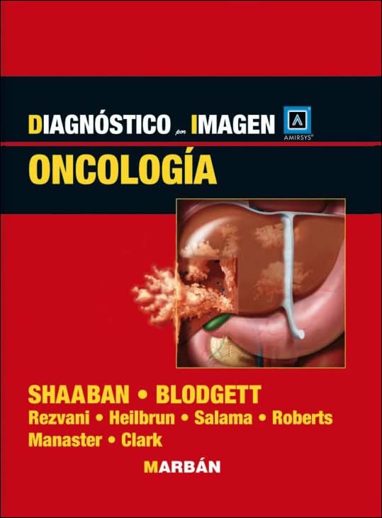 Diagnóstico por imagen. Oncología (Scanned PDF)