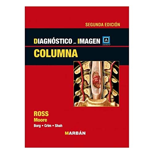 Diagnóstico por Imagen: Columna, 2a Edición (Scanned PDF)
