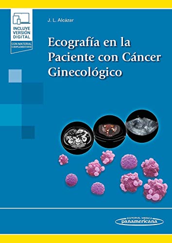 Ecografía en la Paciente con Cáncer Ginecológico (Original PDF from Publisher)