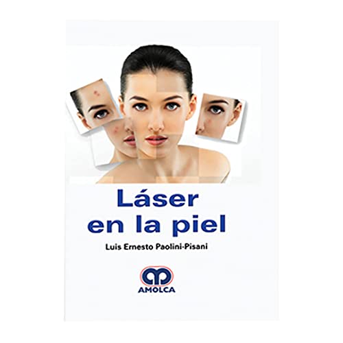 Láser en la piel (Scanned PDF)