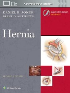 Master Techniques in Surgery: Hernia, 2nd Edition (Videos only)