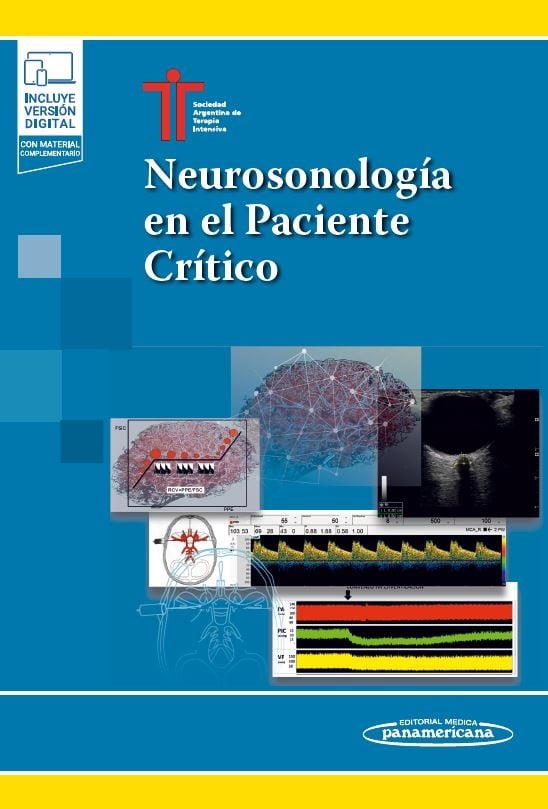 Neurosonología en el Paciente Crítico (Original PDF from Publisher)
