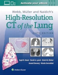 Webb, Müller and Naidich's High-Resolution CT of the Lung, 6th edition (Original PDF from Publisher)