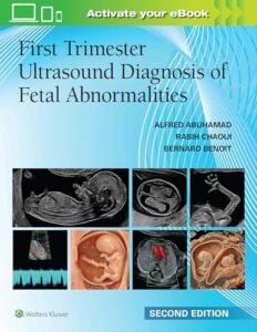First Trimester Ultrasound Diagnosis of Fetal Abnormalities, 2nd edition (EPUB)