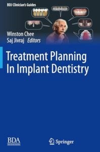Treatment Planning In Implant Dentistry (BDJ Clinician’s Guides), 2nd edition (Original PDF from Publisher)