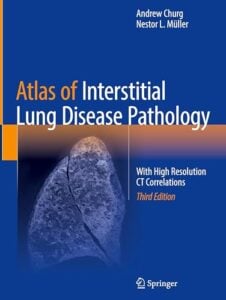 Atlas of Interstitial Lung Disease Pathology: With High Resolution CT Correlations, 3rd edition (Original PDF from Publisher)