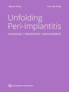 Unfolding Peri-Implantitis: Diagnosis, Prevention and Management, 2nd edition (EPUB)