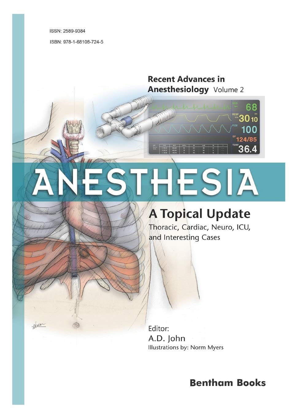 Anesthesia: A Topical Update – Thoracic, Cardiac, Neuro, ICU, and Interesting Cases (Original PDF from Publisher)