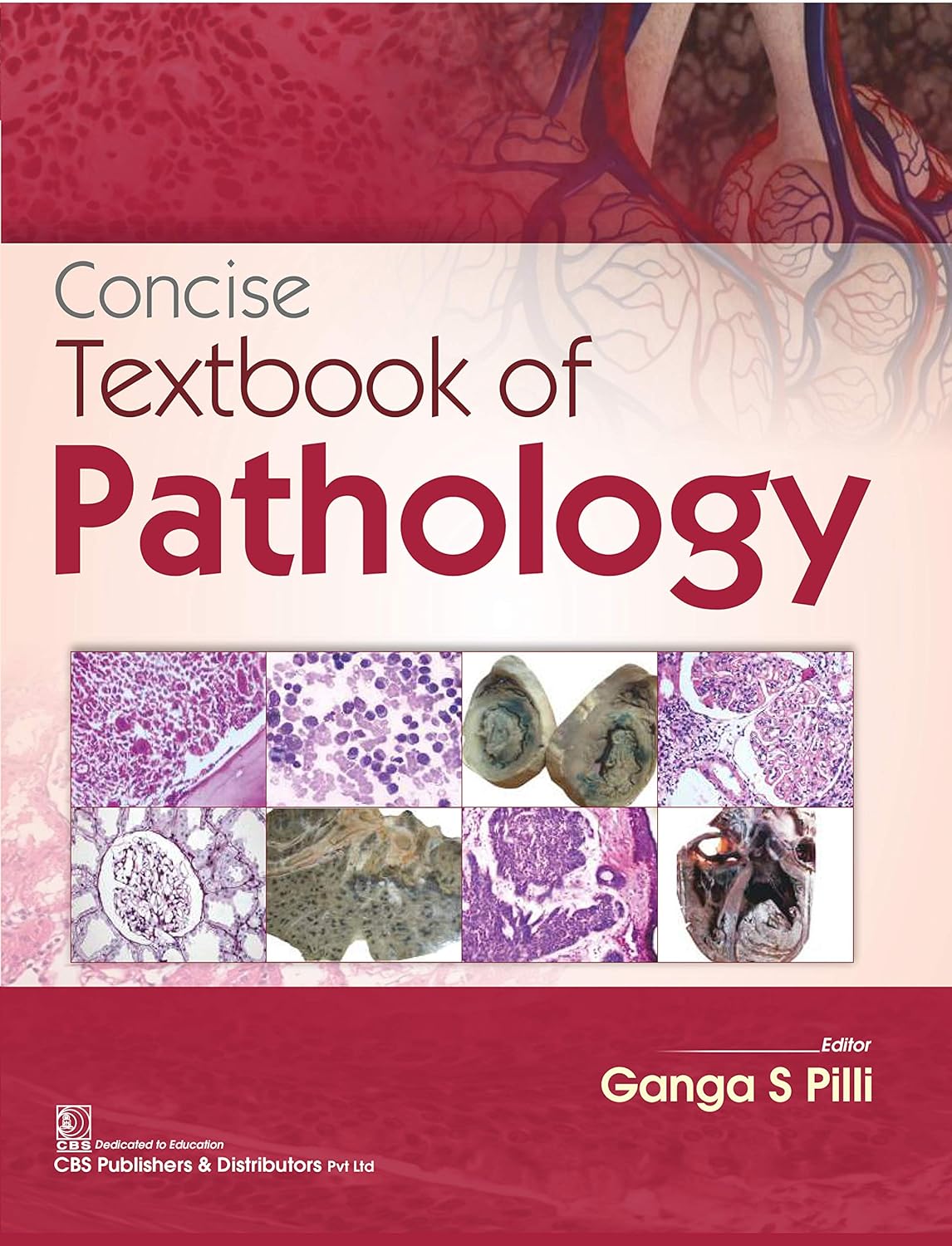 Concise Textbook of Pathology (Original PDF from Publisher)