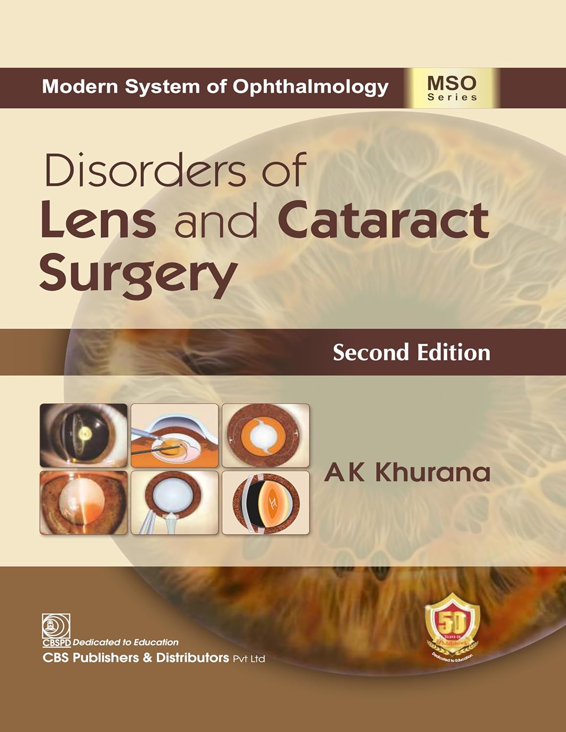 Disorders of Lens and Cataract Surgery (Original PDF from Publisher)