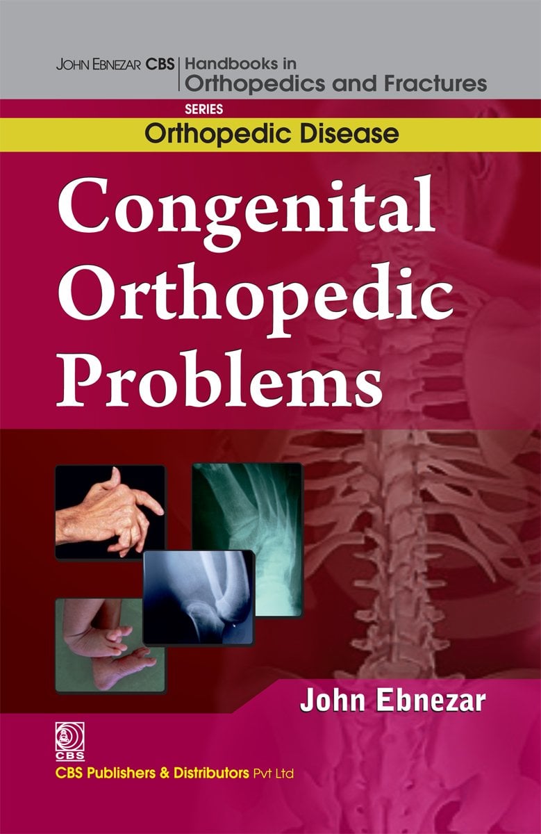 Congenital Orthopedic Problems (EPUB)