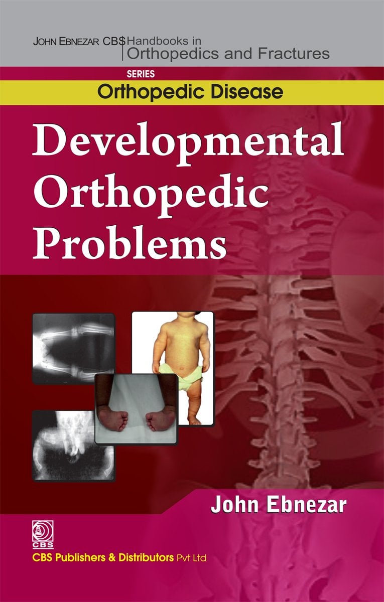 Developmental Orthopedic Problem (EPUB)