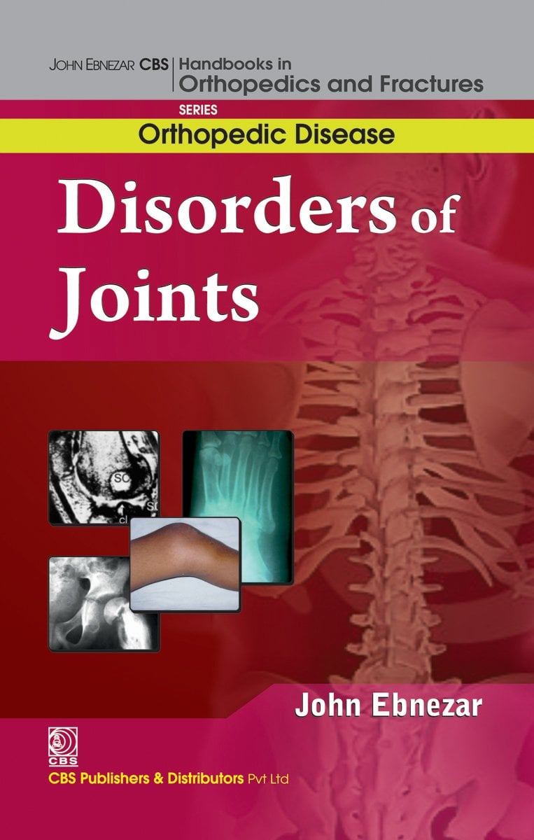 Disorder of Joint (EPUB)