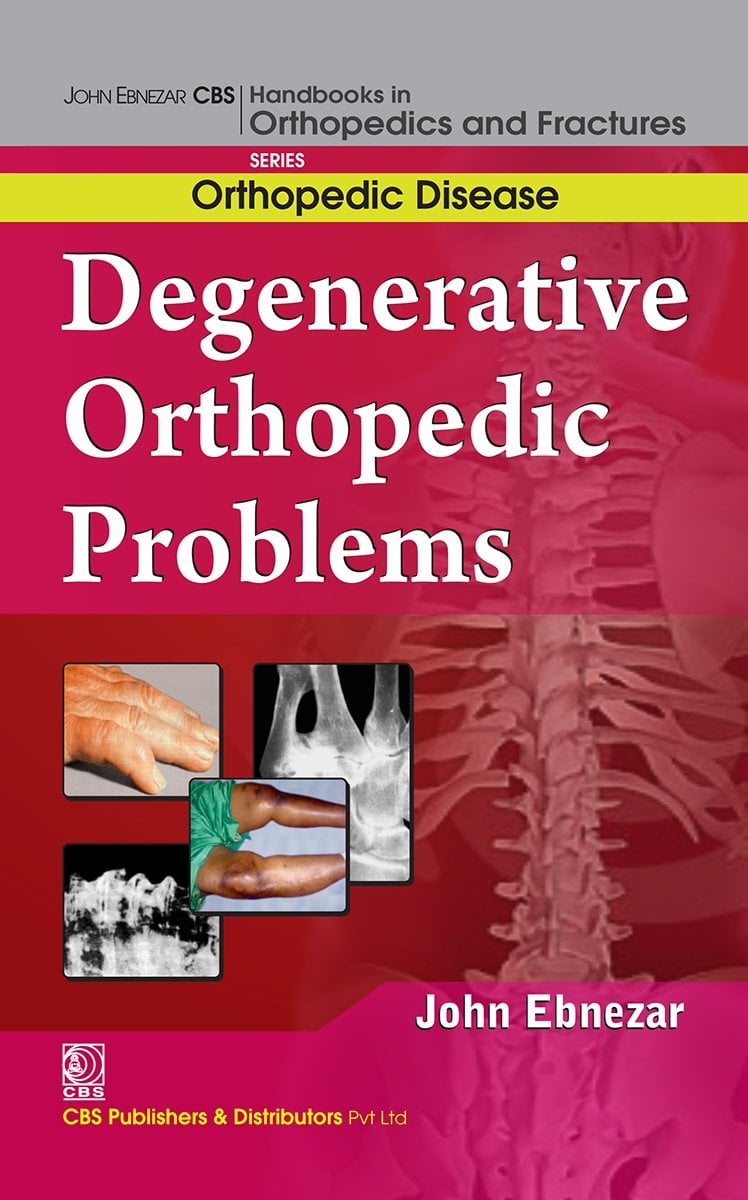 Degenerative Orthopedic Problems (EPUB)