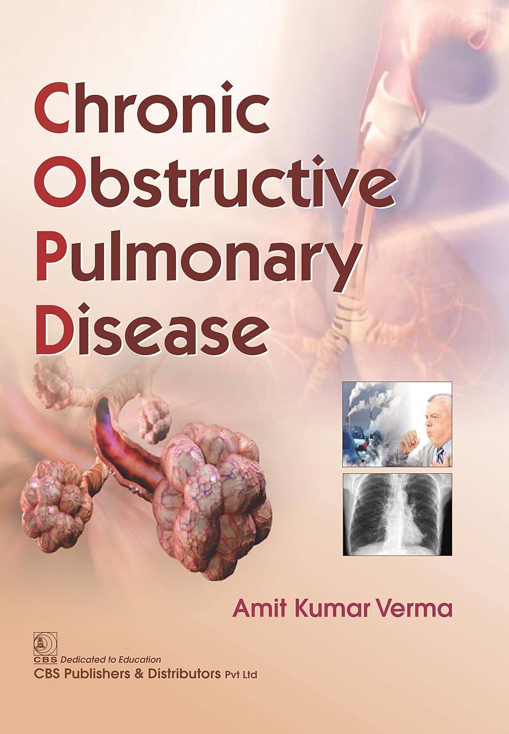 COPD Chronic Obstructed Pulmonary Disease (Original PDF from Publisher)