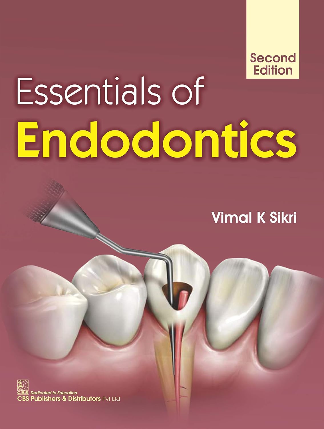 Essentials of Endodontics, 2nd Edition (Original PDF from Publisher)