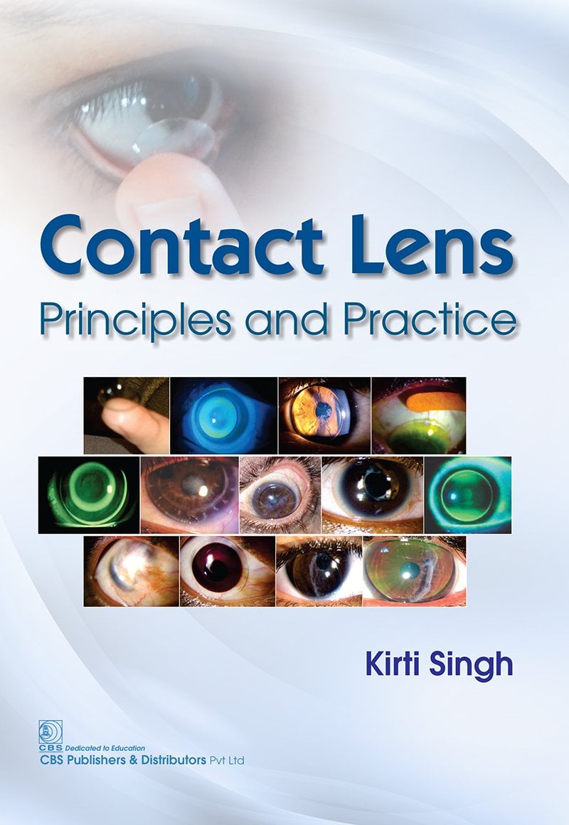 Contact lens Principle and Practice (EPUB)