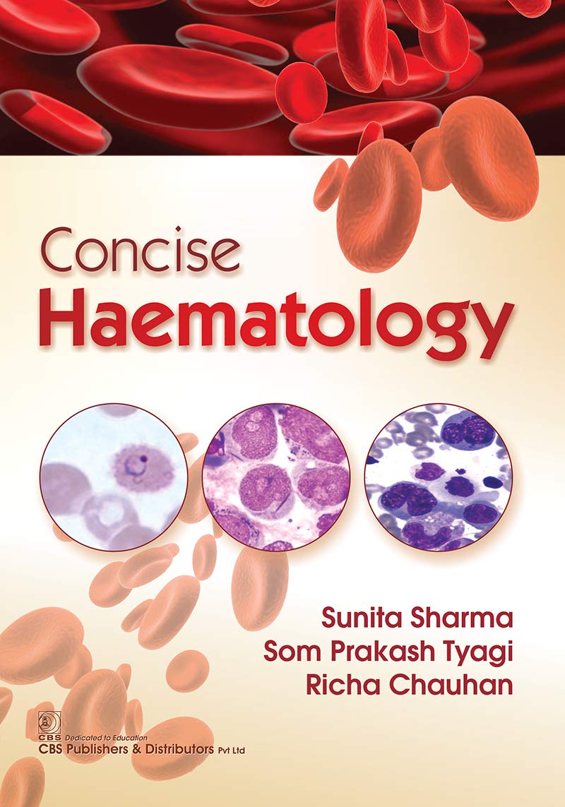 Concise Haematology (EPUB)
